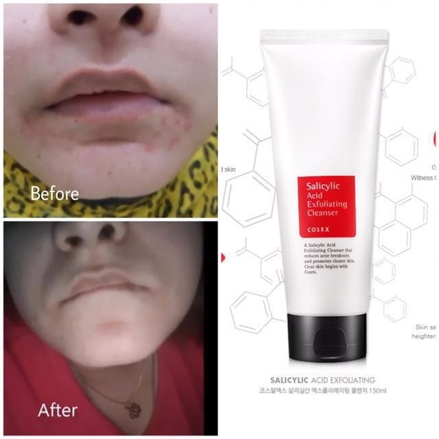 Salicylic Acid Daily Gentle Cleanser - COSRX - Imagen 5